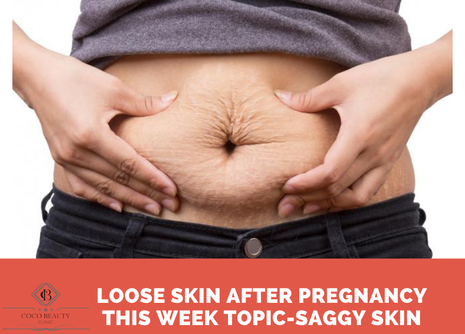 Saggy Belly Skin After Pregnancy: What To Do And What To Avoid